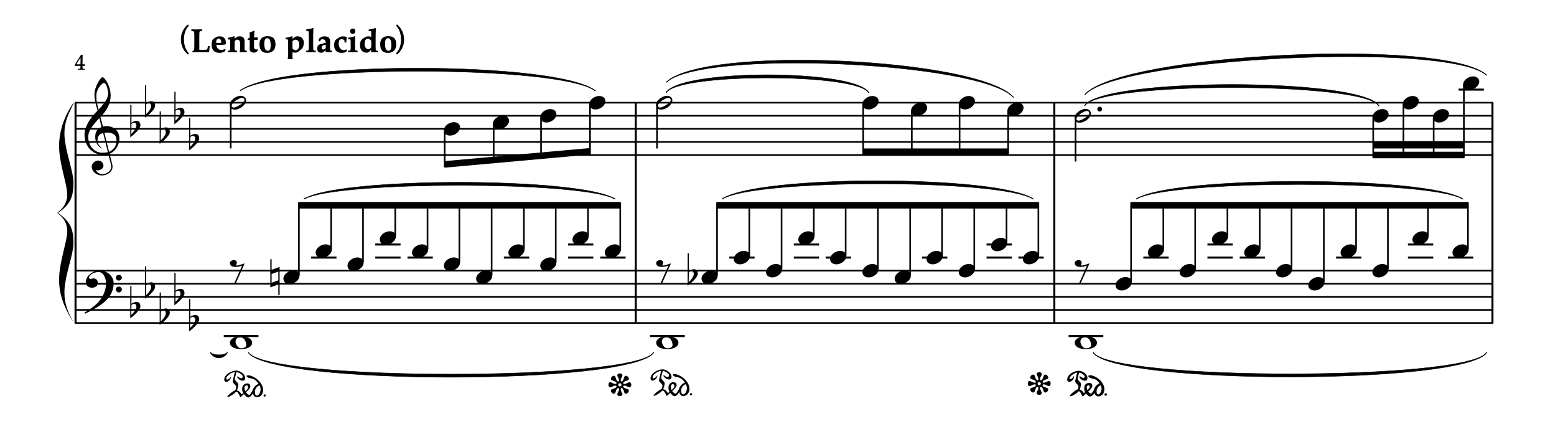 リスト作曲「コンソレーション 第3番」の4-6小節目の楽譜。バス音のタイと和声変化によるペダリング問題を示した譜例