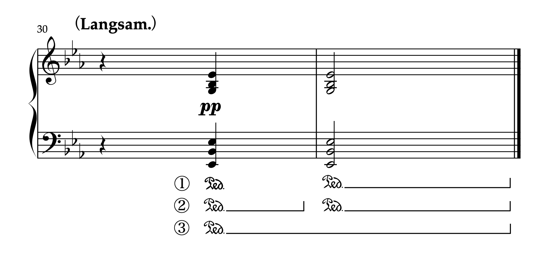 クララ編曲「君の顔」30-31小節 終結部のペダリングパターン3種類を示した譜例。