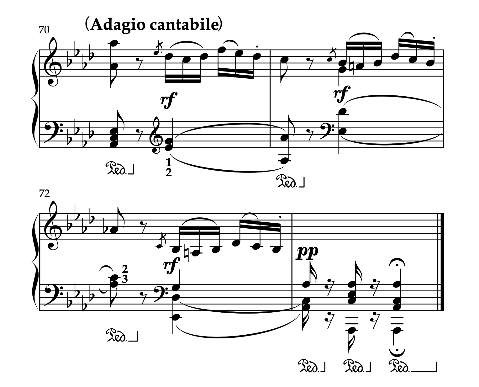 ベートーヴェン「ピアノソナタ 第8番 悲愴 ハ短調 Op.13 第2楽章」70-73小節。コーダのアーティキュレーション。