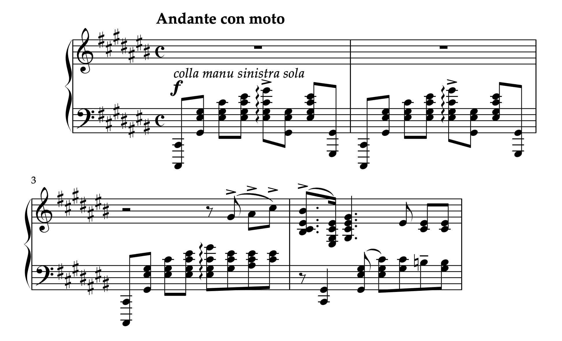 ボルトキエヴィチ「4つのピアノ曲 第3番 より 祝婚歌 Op.65-3」1-4小節
